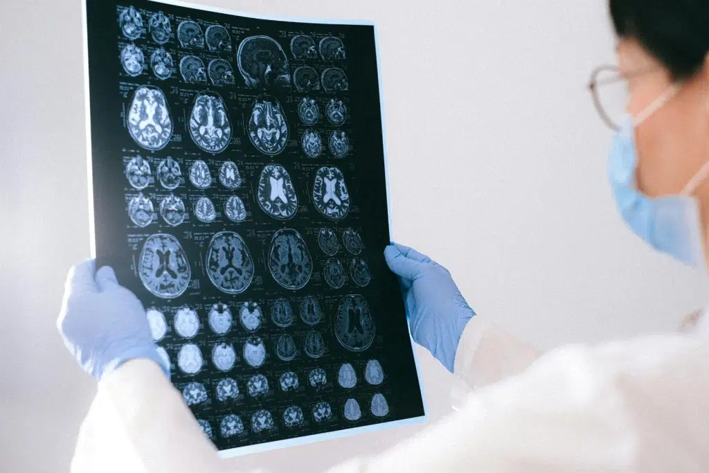Médecin tenant une radio dans les mains