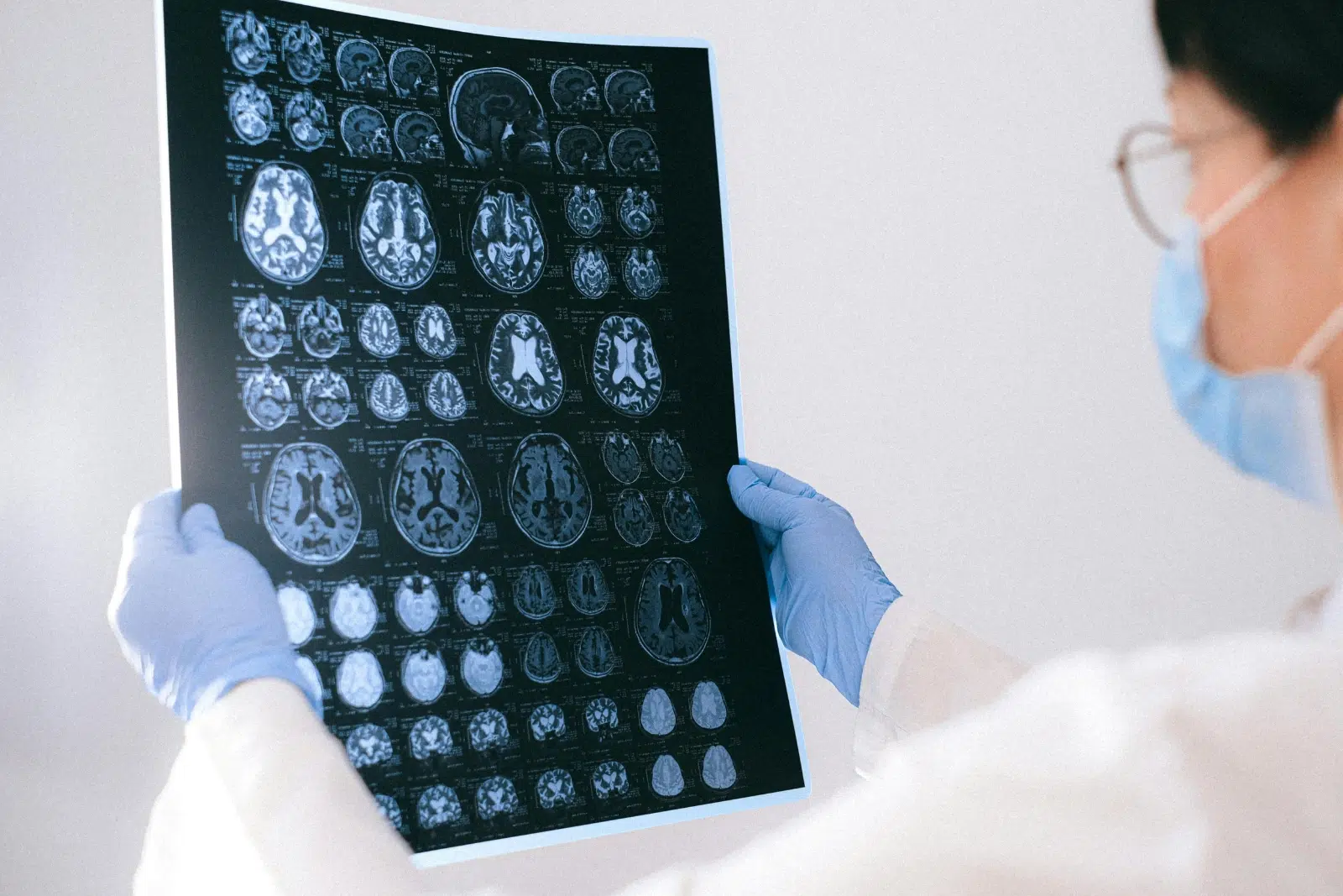 Médecin tenant une radio dans les mains